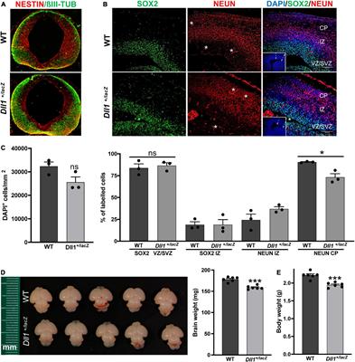 Dll1 haploinsufficiency causes brain abnormalities with functional relevance